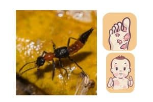 cửa lưới chống kiến ba khoang đốt